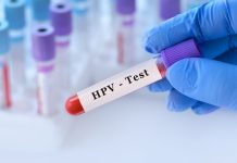 Više od 4000 žena testirano na HPV i PAP test u Beogradu i Nišu hpv