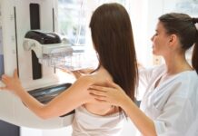 Mobilni mamograf ispred Doma zdravlja u Lučanima